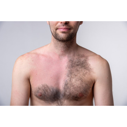 Chest Waxing